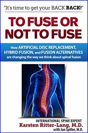 To Fuse or Not to Fuse: How Artificial Disc Replacement, Hybrid Fusion, and Fusion Alternatives are Changing the World of Spinal Fusion by Karsten Ritter-Lang, Jan Spiller