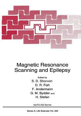 Magnetic Resonance Scanning and Epilepsy by 