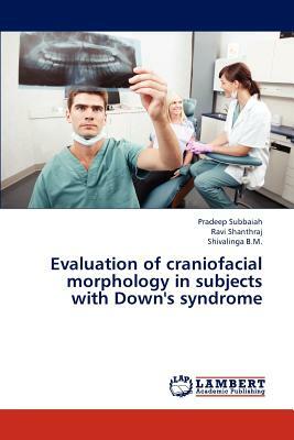 Evaluation of Craniofacial Morphology in Subjects with Down's Syndrome by Subbaiah Pradeep, Shanthraj Ravi, B. M. Shivalinga