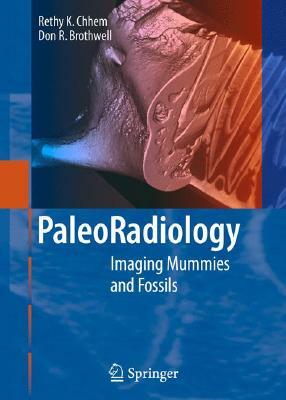 Paleoradiology: Imaging Mummies and Fossils by D. R. Brothwell, R. K. Chhem