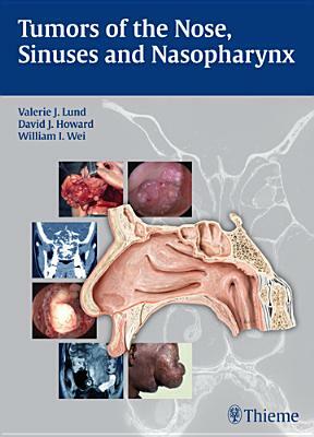 Tumors of the Nose, Sinuses and Nasopharynx by David Howard, Valerie J. Lund, W. I. Wei