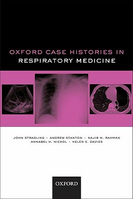 Oxford Case Histories in Respiratory Medicine by Andrew Stanton, Annabel H. Nickol, John Stradling