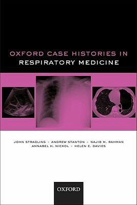 Oxford Case Histories in Respiratory Medicine by John Stradling, Andrew Stanton, Annabel H. Nickol