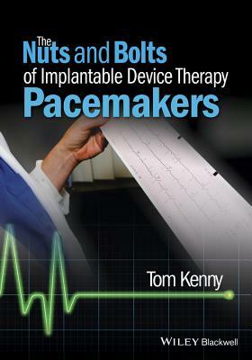 The Nuts and Bolts of Implantable Device Therapy: Pacemakers by Tom Kenny