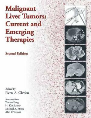 Malignant Liver Tumors: Current and Emerging Therapies by H. Kim Lyerly, Michael A. Morse