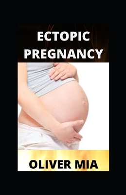 Ectopic Pregnancy: Diagnosis and Management by Oliver Mia