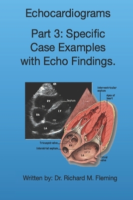 Echocardiograms - Part 3: Specific Case Examples with Echo Findings. by Richard M. Fleming