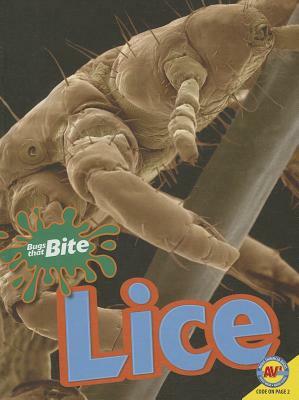 Lice by Pamela McDowell