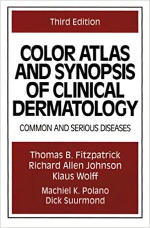 Color Atlas and Synopsis of Clinical Dermatology: Common and Serious Diseases by Klaus Wolff, Richard Allen Johnson