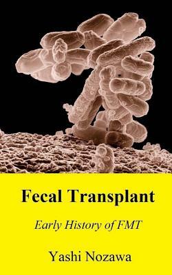 Fecal Transplant: Early History of FMT by Yashi Nozawa