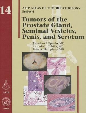 Tumors of the Prostate Gland, Seminal Vesicles, Penis, and Scrotum by Jonathan I. Epstein