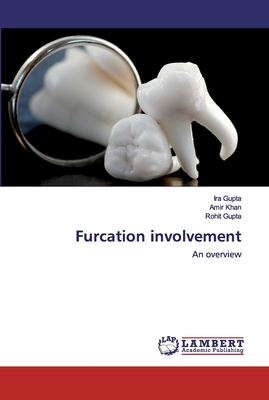Furcation involvement by Amir Khan, Ira Gupta, Rohit Gupta