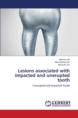 Lesions associated with impacted and unerupted tooth by Anand Kr Jha, Abhinav Jha, Namrata Kumari
