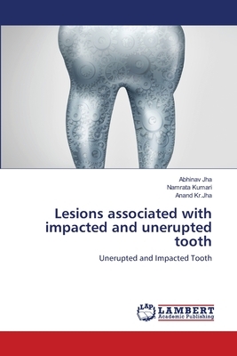 Lesions associated with impacted and unerupted tooth by Anand Kr Jha, Namrata Kumari, Abhinav Jha