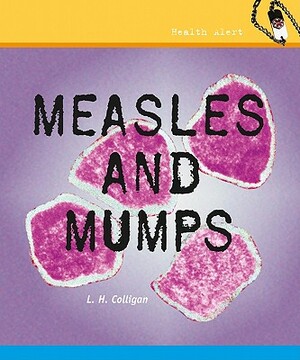 Measles and Mumps by L. H. Colligan