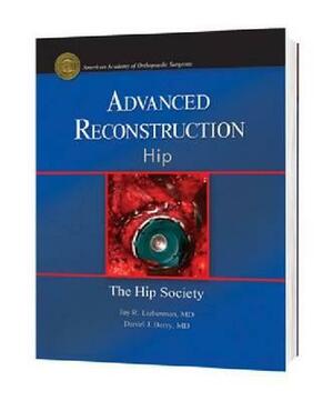 Advanced Reconstruction - Hip by Jay Lieberman
