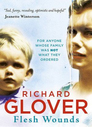 Flesh Wounds by Richard Glover
