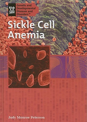 Sickle Cell Anemia by Judy Monroe Peterson