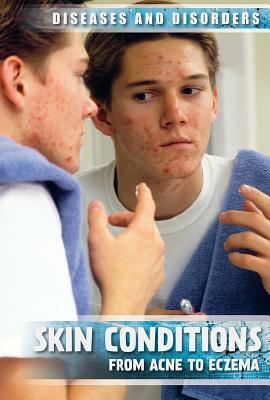Skin Conditions: From Acne to Eczema by Donna Reynolds
