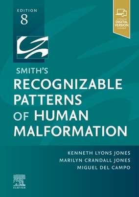 Smith's Recognizable Patterns of Human Malformation: Expert Consult - Online and Print by Miguel del Campo, Marilyn Crandall Jones, Kenneth Lyons Jones