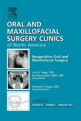 Reoperative Oral and Maxillofacial Surgery, an Issue of Oral and Maxillofacial Surgery Clinics, Volume 23-1 by Rui Fernandes, Luis Vega