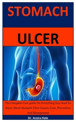 Stomach Ulcer: The Complete Cure guide On Everything You Need To Know About Stomach Ulcer Disease Causes, Cure, Prevention And Manage by Jessica Kate