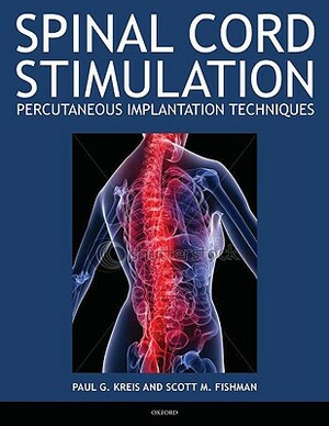 Spinal Cord Stimulation Implantation: Percutaneous Implantation Techniques by Scott Fishman, Paul Kreis