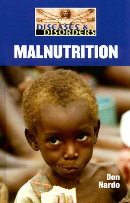 Malnutrition by Don Nardo