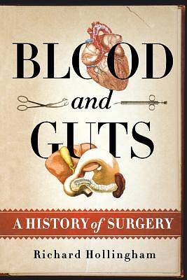 Blood and Guts: A History of Surgery by Richard Hollingham