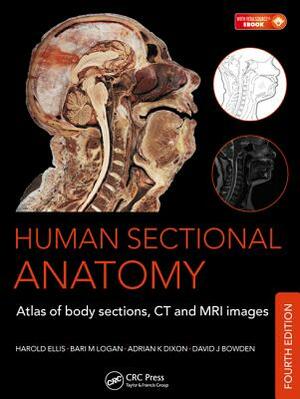 Human Sectional Anatomy: Atlas of Body Sections, CT and MRI Images, Fourth Edition by Adrian K. Dixon, David J. Bowden, Harold Ellis