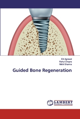 Guided Bone Regeneration by Rahul Chopra, Eiti Agrawal, Nikhil Sharma