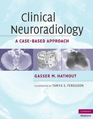 Clinical Neuroradiology: A Case-Based Approach by Gasser M. Hathout