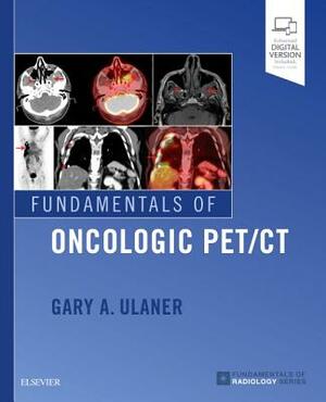 Fundamentals of Oncologic Pet/CT by Gary A. Ulaner