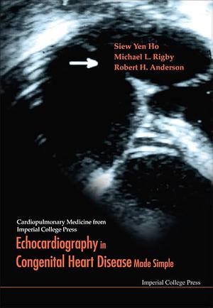 Echocardiography in Congenital Heart Disease Made Simple by Siew Yen Ho, Robert H. Anderson, Michael L. Rigby