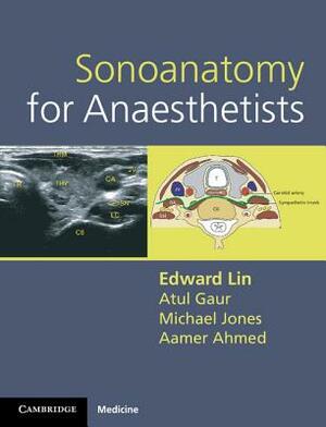 Sonoanatomy for Anaesthetists by Michael Jones, Atul Gaur, Edward Lin