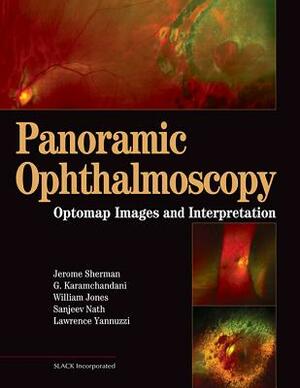 Panoramic Ophthalmoscopy: Optomap Images and Interpretation by Gulshan Karamchandani, Jerry Sherman, William Jones