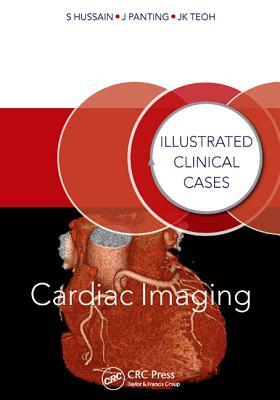 Cardiac Imaging: Illustrated Clinical Cases by Shahid Hussain, Jun Kiat Teoh, Jonathan Panting