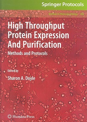 High Throughput Protein Expression and Purification: Methods and Protocols by 