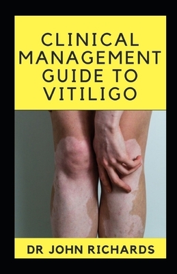 Clinical Management Guide To Vitiligo: Guide To Vitiligo by John Richards