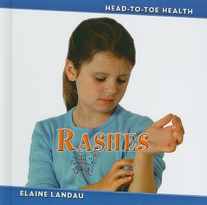 Rashes by Elaine Landau