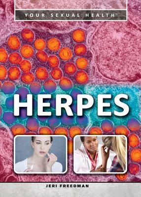 Herpes by Jeri Freedman