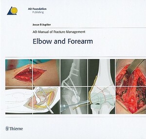 Ao Manual of Fracture Management - Elbow & Forearm by Ao Publishing, Jesse Jupiter