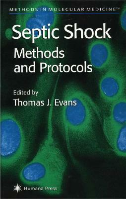 Septic Shock Methods and Protocols by 