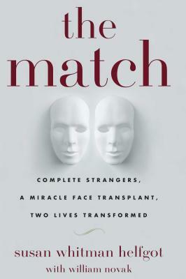 The match : complete strangers, a miracle face transplant, two lives transformed by Susan Whitman Helfgot, William Novak