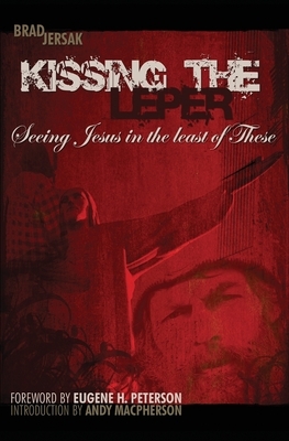 Kissing the Leper: Seeing Jesus in the Least of These by 