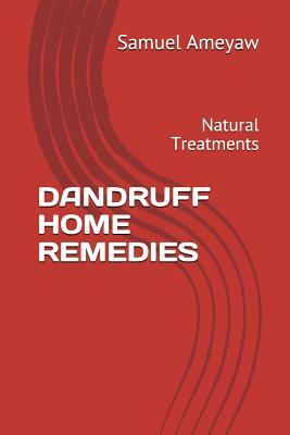 Dandruff Home Remedies: Natural Treatments by Samuel Ameyaw