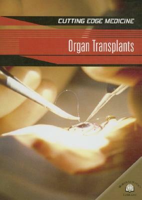 Organ Transplants by Carol Ballard