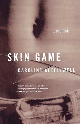 Skin Game: A Memoir by Caroline Kettlewell