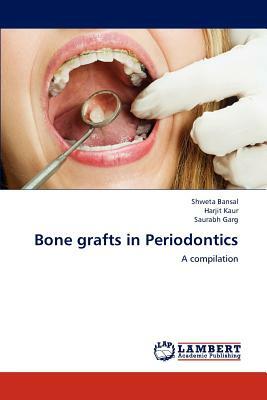 Bone Grafts in Periodontics by Harjit Kaur, Shweta Bansal, Saurabh Garg