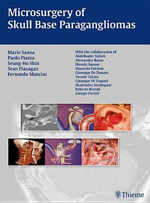 Microsurgery of Skull Base Paragangliomas by Mario Sanna, Paolo Piazza, Seung-Ho Shin